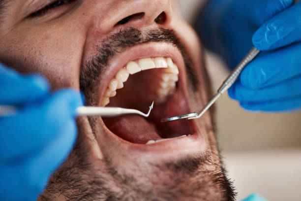 Best Emergency Dental Care for Broken or Chipped Teeth in North Ogden, UT
