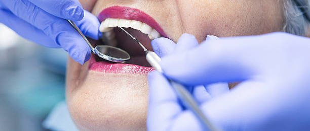 Best Emergency Denture Repair in North Ogden, UT